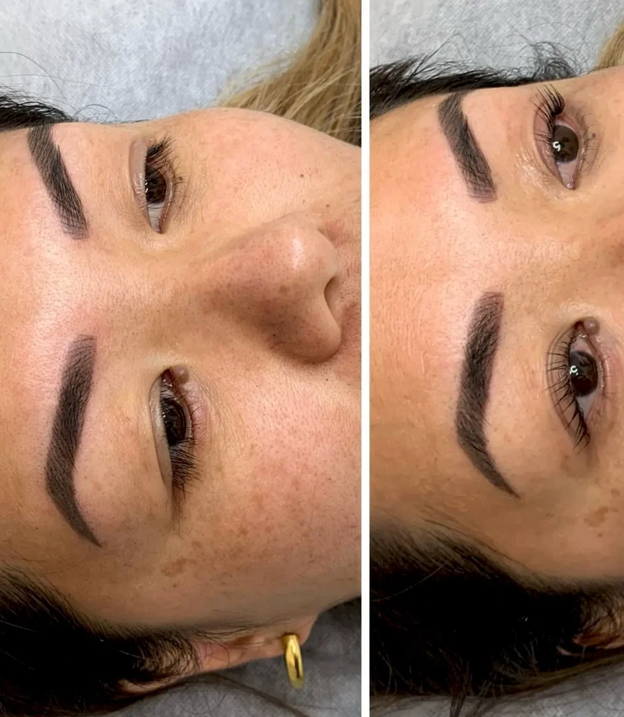 cosmetic tattoo