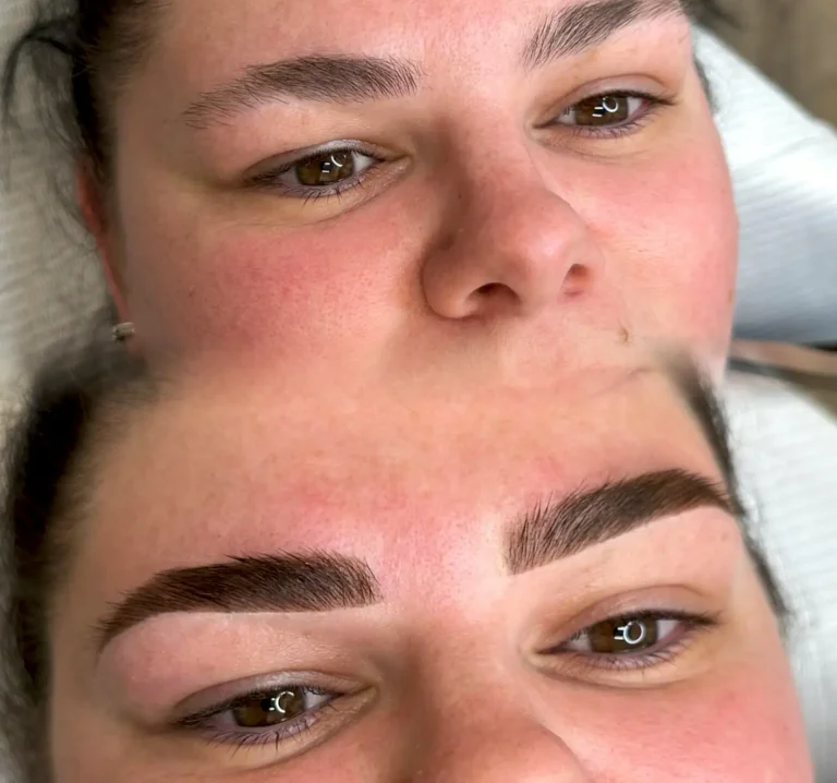 Do cosmetic tattoo hurt more as you age?