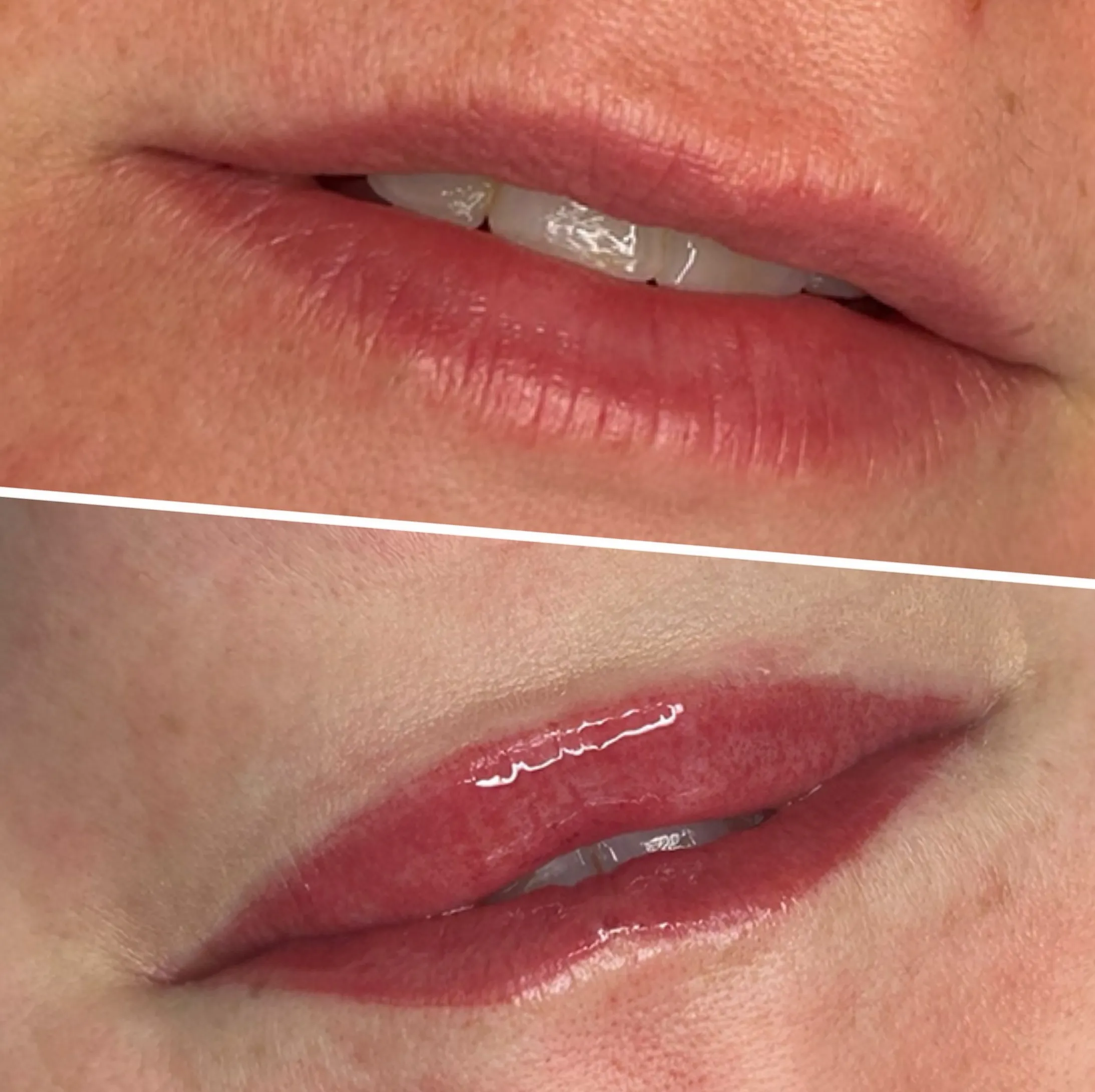 lip blush swelling