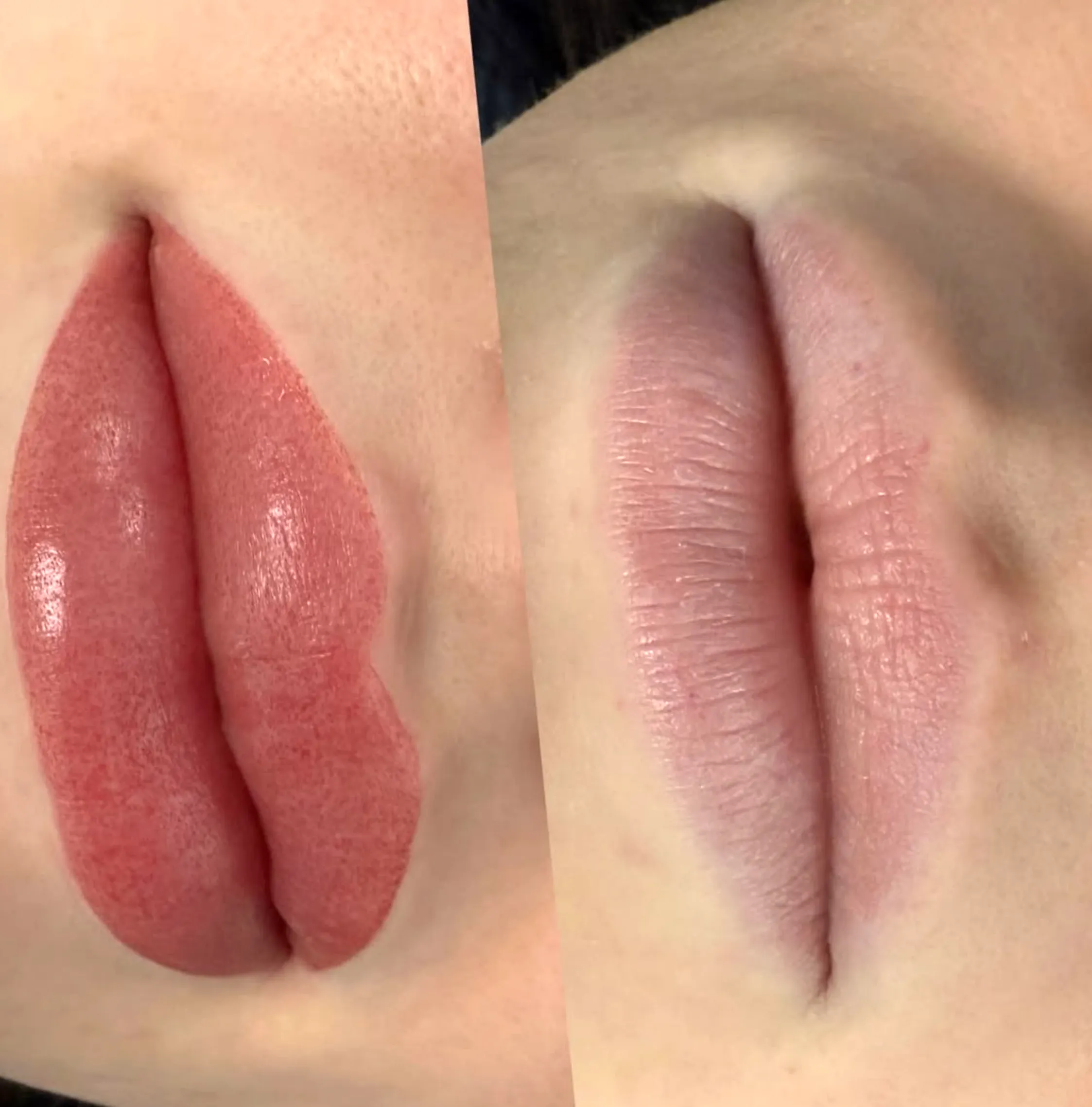 lip tattoo vs filler