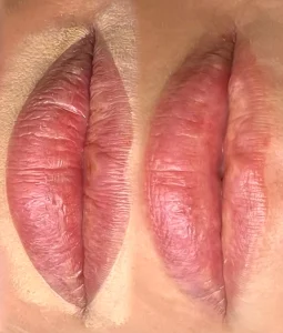 lip blush bigger lips