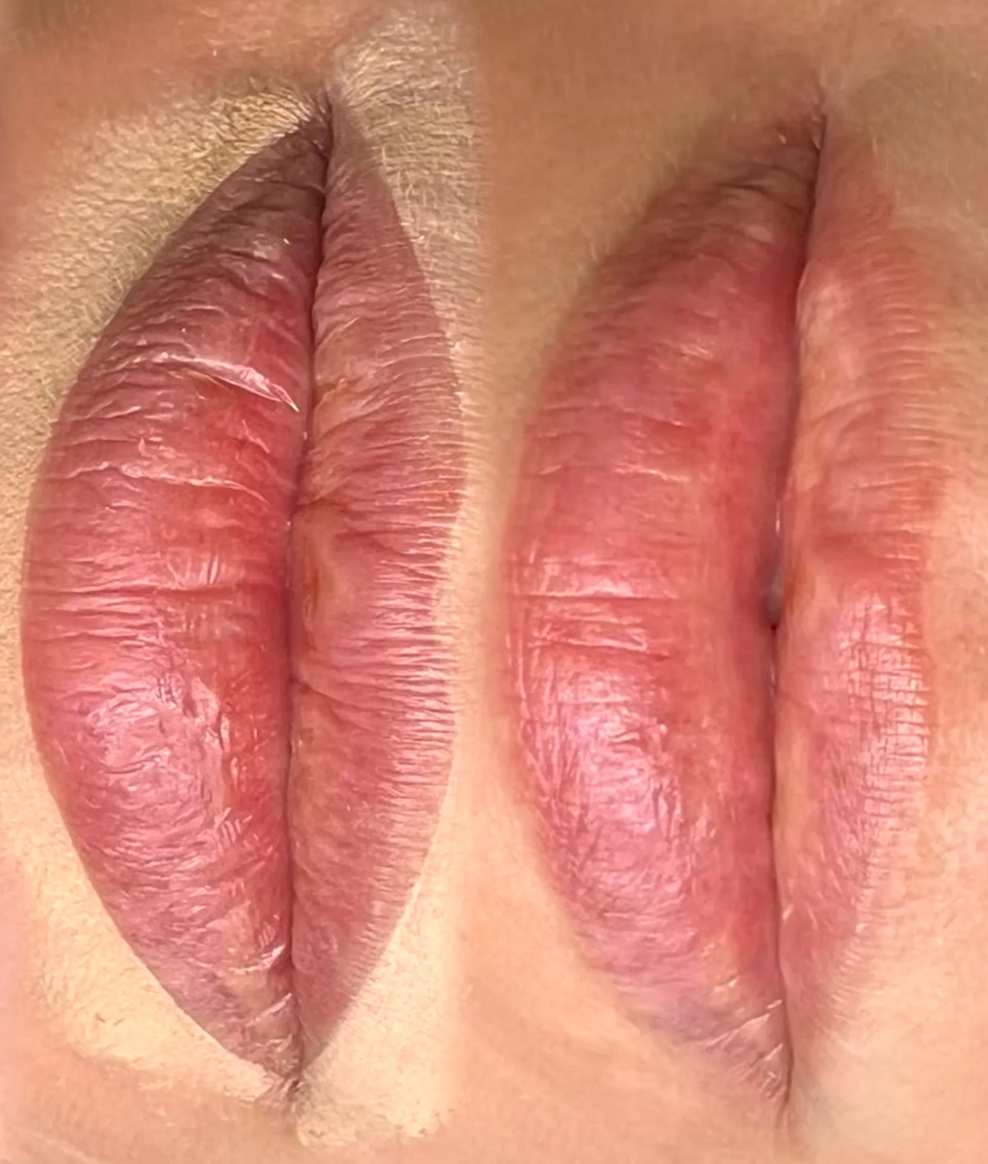 Can Lip Blushing Make Lips Appear Bigger?